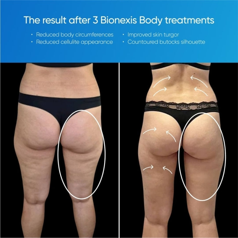 Zemits Bionexis Lite Système de Contournage Professionnel