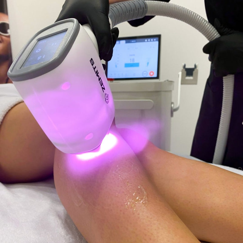 Zemits Quidion Laser Diode Pour L'épilation