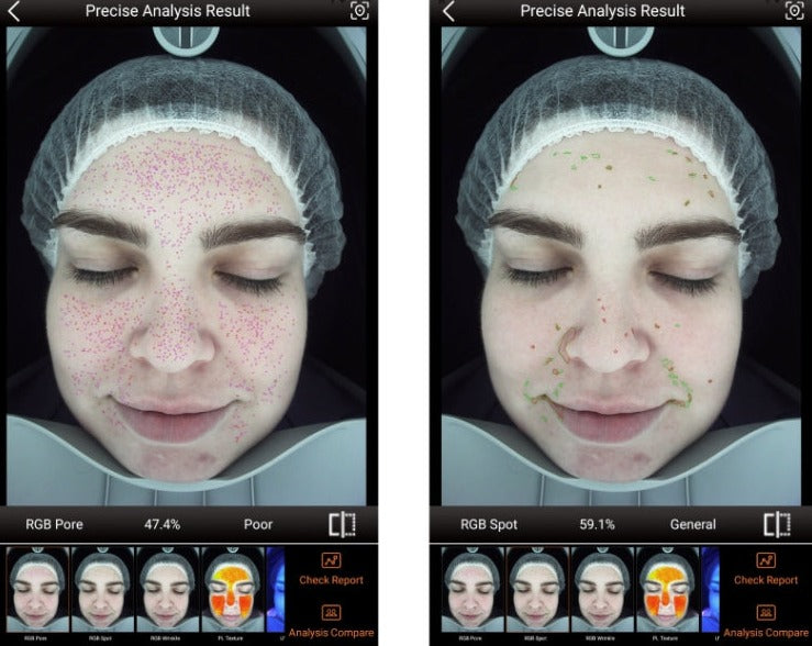 Zemits VeraFace Système d'analyse de la peau