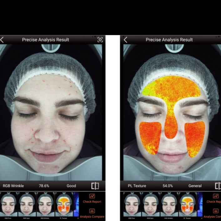 Zemits VeraFace Système d'analyse de la peau